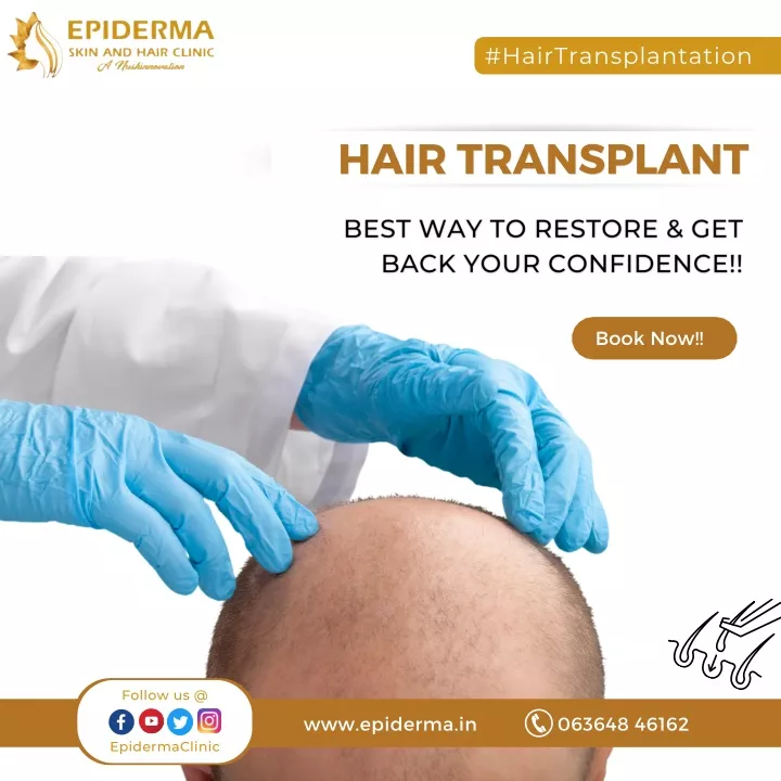 hairtransplantation