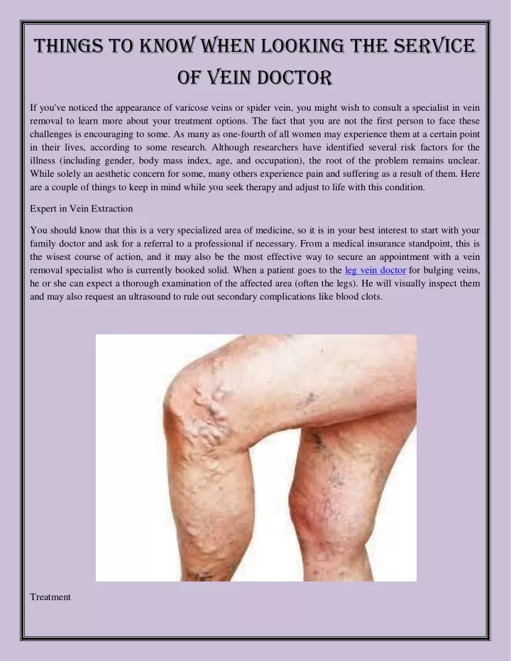 things to know when looking the service of vein