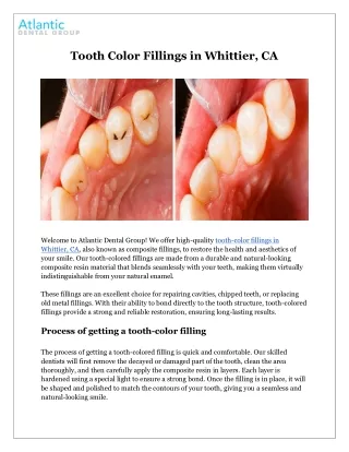 Tooth Color Fillings in Whittier, CA