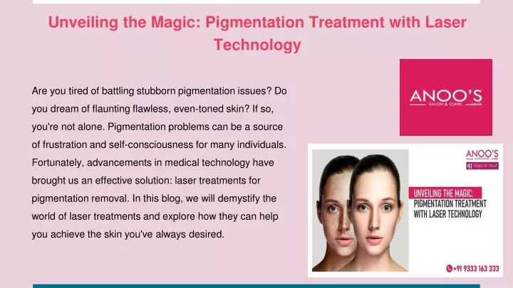 unveiling the magic pigmentation treatment with laser technology