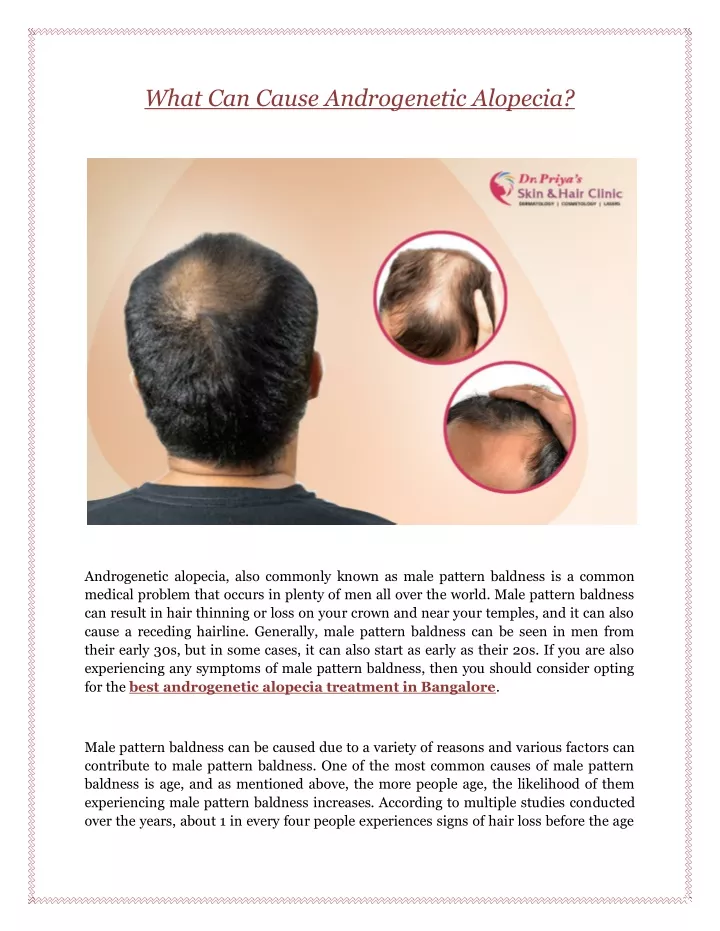 what can cause androgenetic alopecia