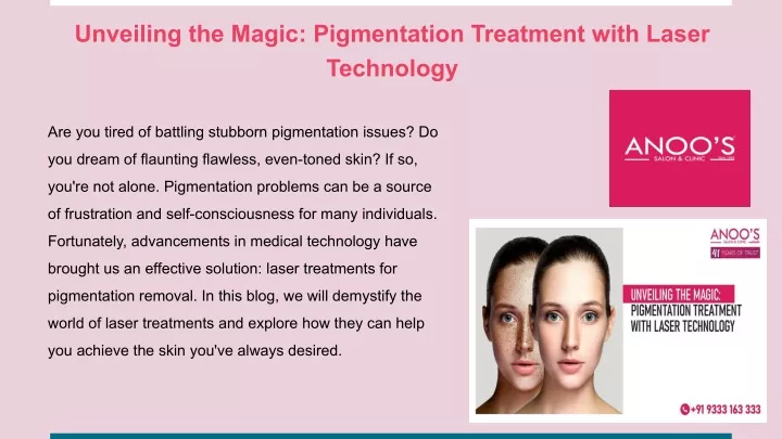 unveiling the magic pigmentation treatment with