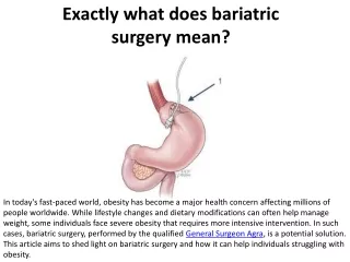 What does bariatric surgery include specifically?
