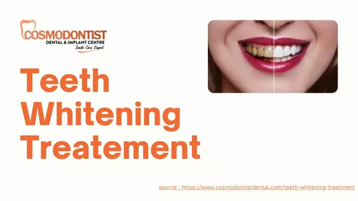 teeth whitening treatement