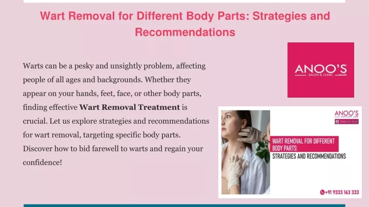 wart removal for different body parts strategies and recommendations