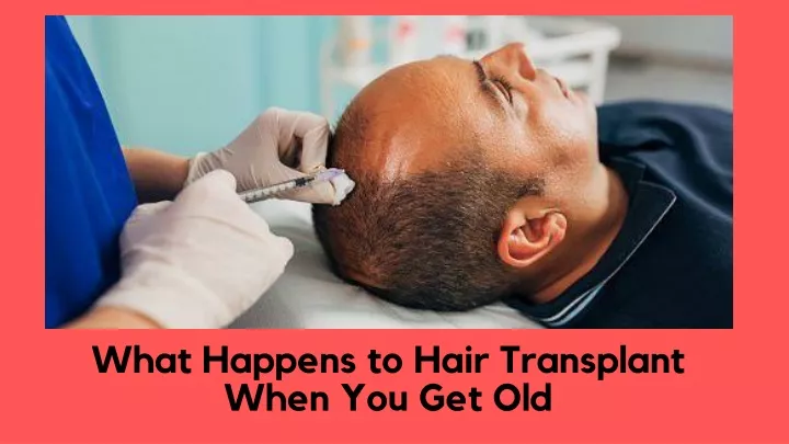 what happens to hair transplant when you get old
