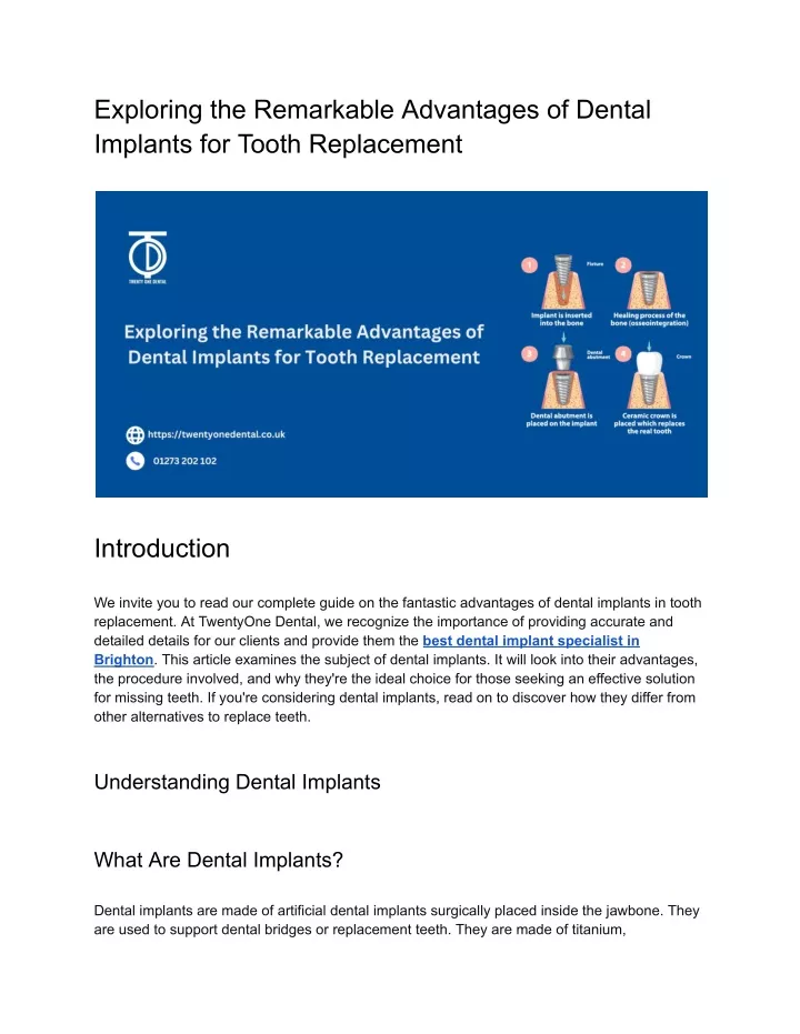 exploring the remarkable advantages of dental