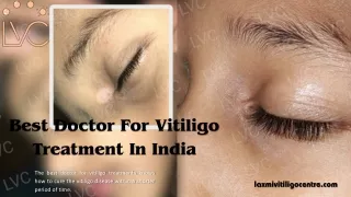 Best Doctor for Vitiligo Treatment in india
