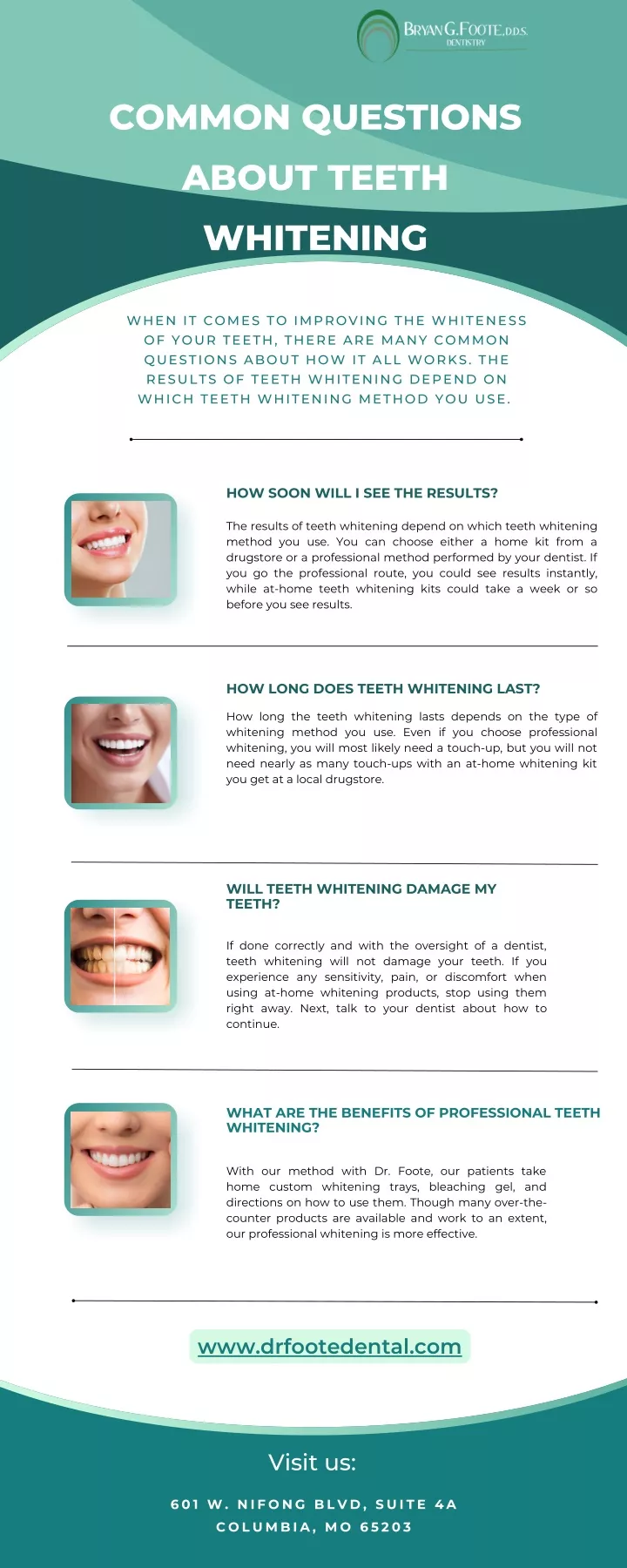 common questions about teeth whitening