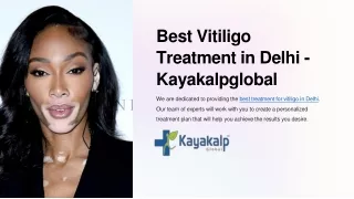 Best Vitiligo Treatment in Delhi