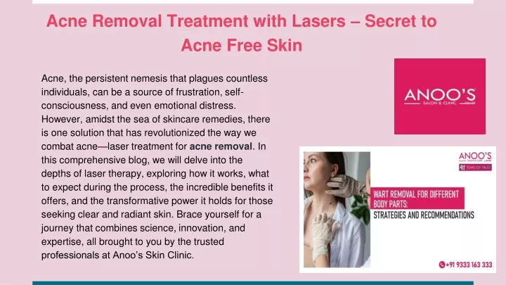 acne removal treatment with lasers secret to acne free skin