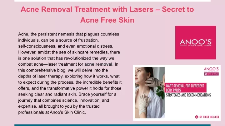 acne removal treatment with lasers secret to acne