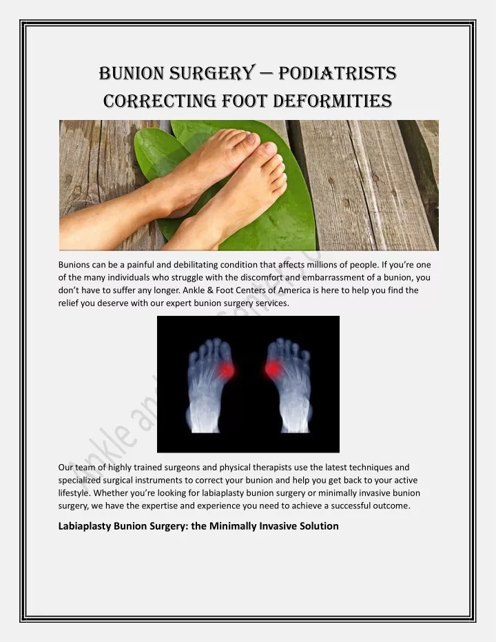 bunion surgery podiatrists correcting foot