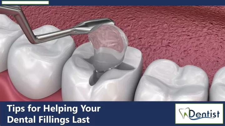 tips for helping your dental fillings last