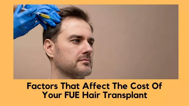 factors that affect the cost of your fue hair