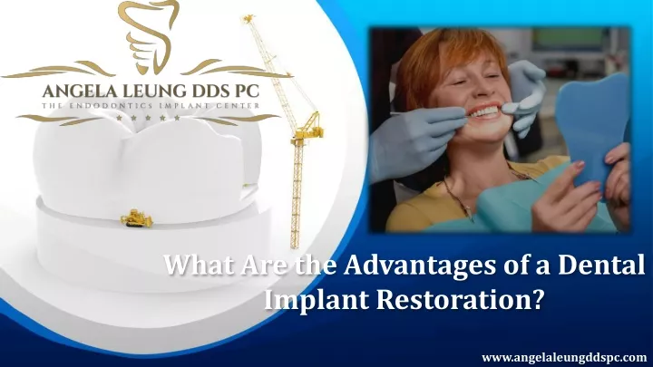 what are the advantages of a dental implant