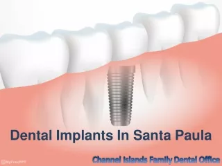 Dental Implants In Santa Paula