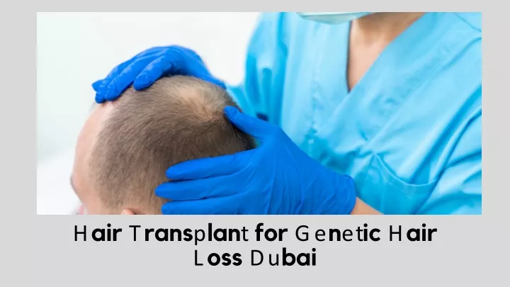 hair transplant for genetic hair loss dubai