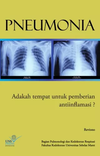 Buku_Pneumonia_by_Dr_Reviono
