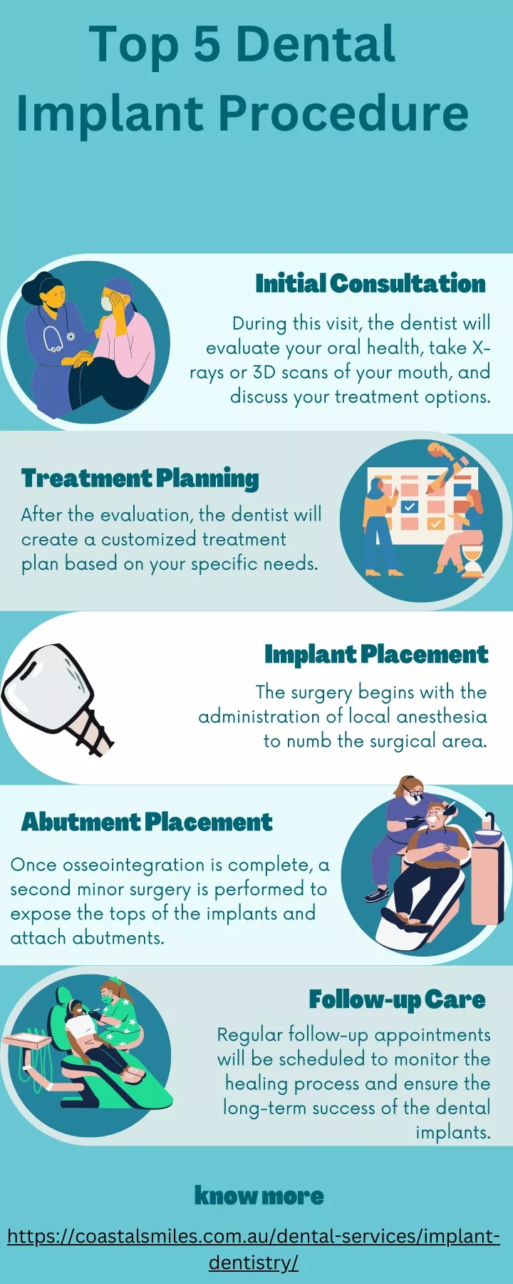 top 5 dental implant procedure