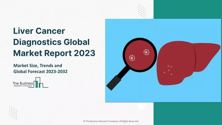 liver cancer diagnostics global market report 2023