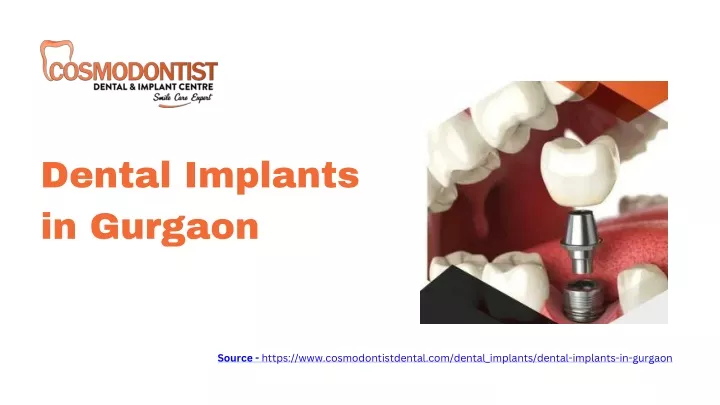 dental implants in gurgaon
