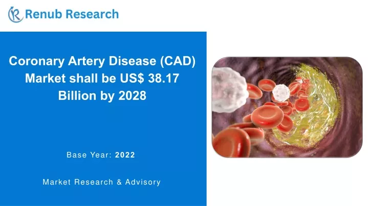 coronary artery disease cad market shall