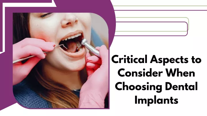 critical aspects to consider when choosing dental