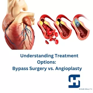 Bypass Surgery vs. Angioplasty