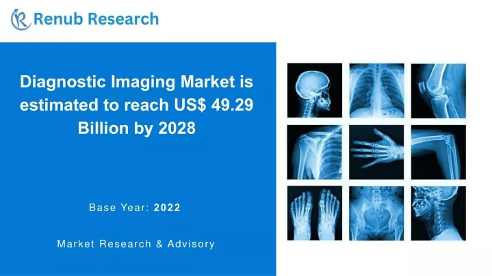 diagnostic imaging market is estimated to reach