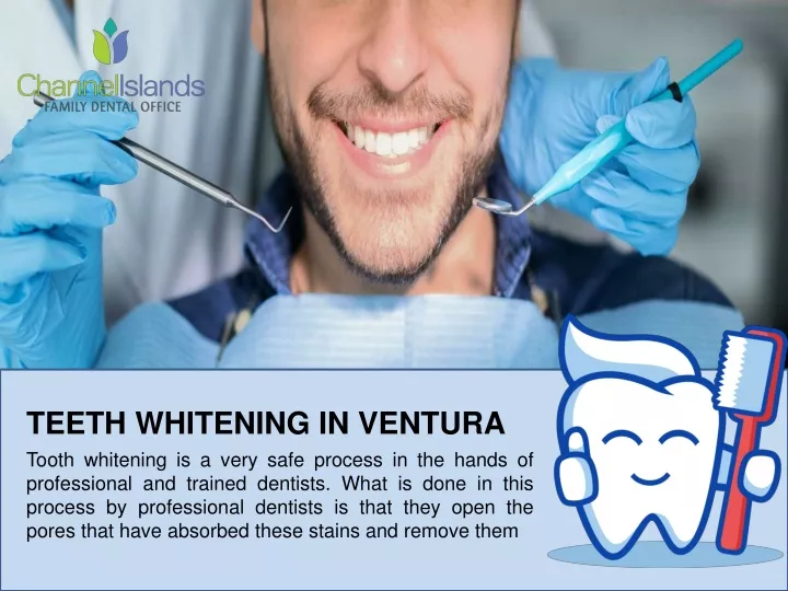 teeth whitening in ventura