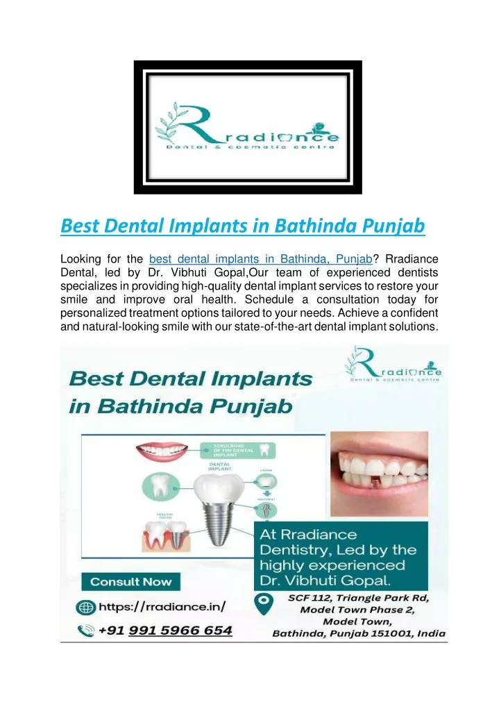 best dental implants in bathinda punjab