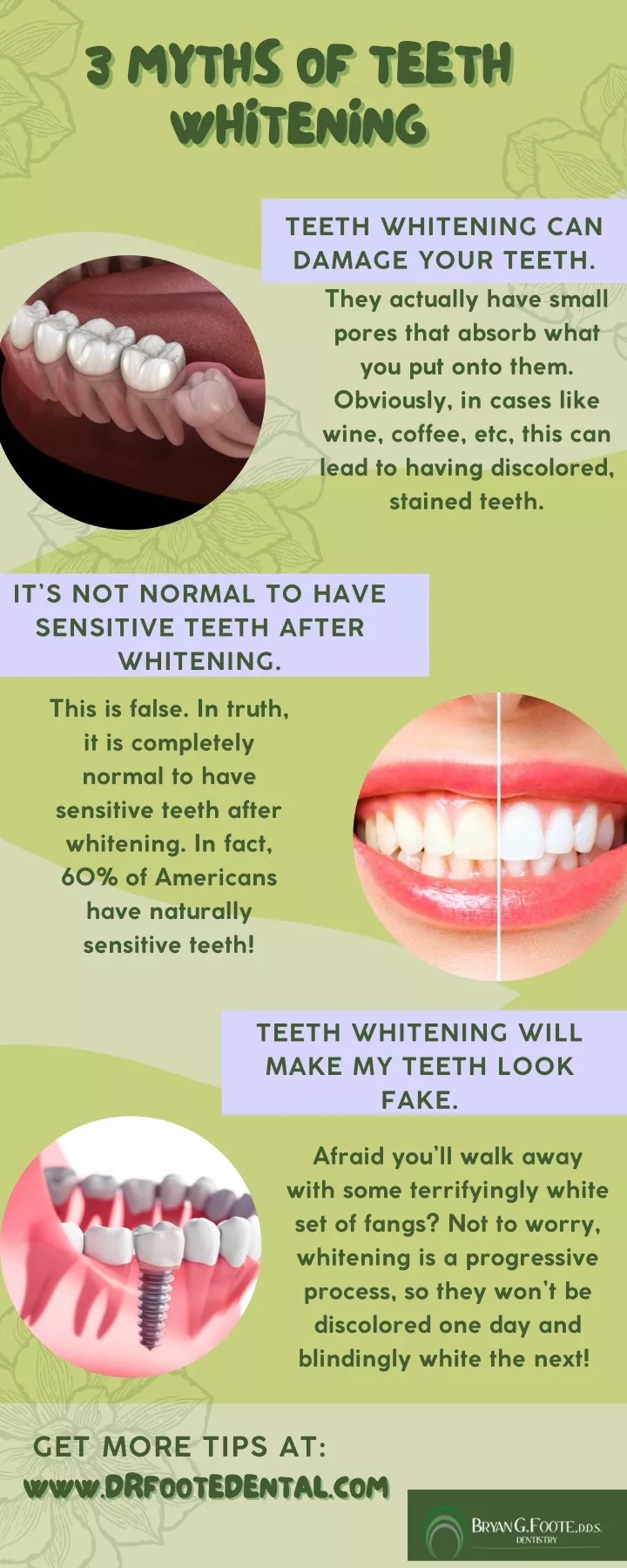 3 myths of teeth whitening