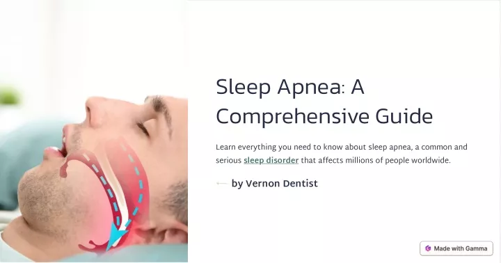 sleep apnea a comprehensive guide