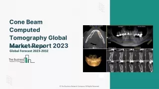 cone beam computed tomography global market