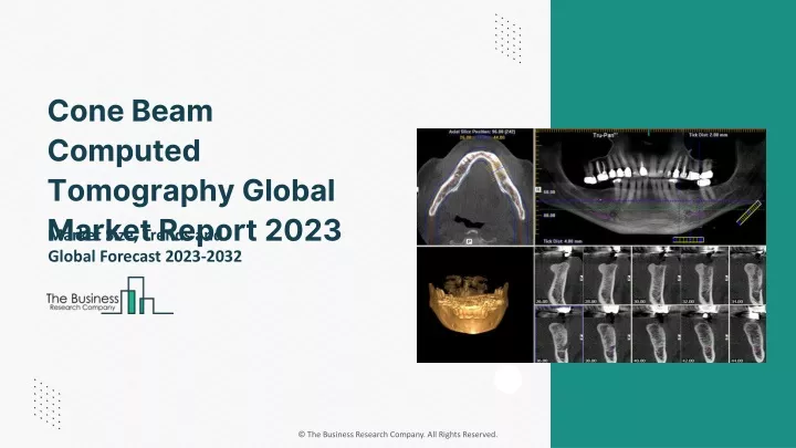 cone beam computed tomography global market