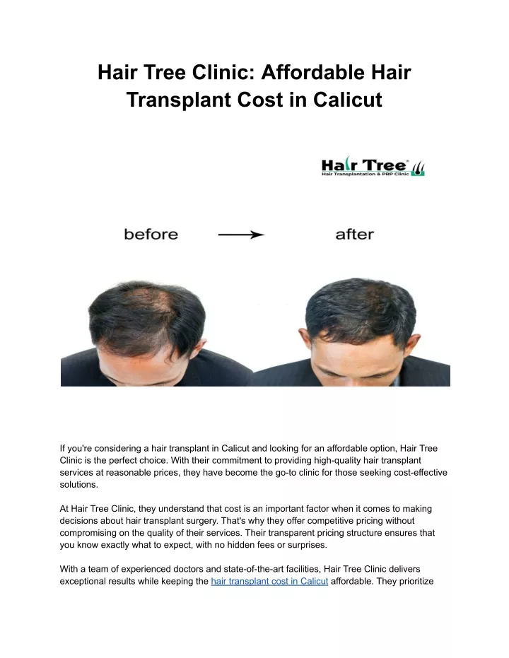 hair tree clinic affordable hair transplant cost