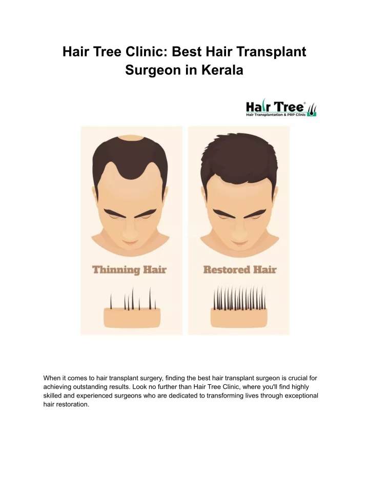 hair tree clinic best hair transplant surgeon
