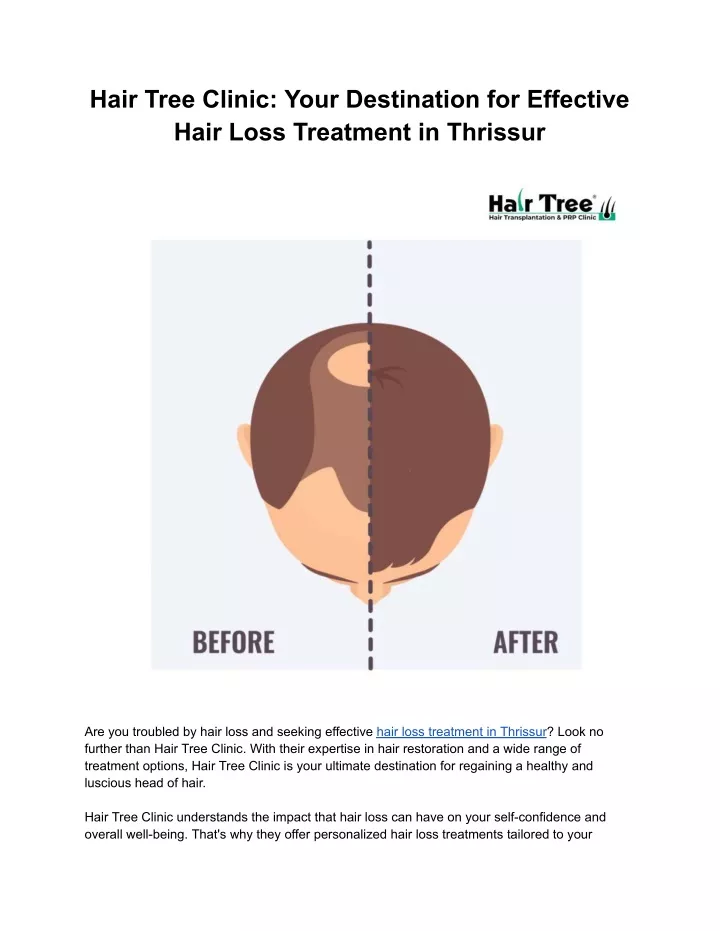 hair tree clinic your destination for effective