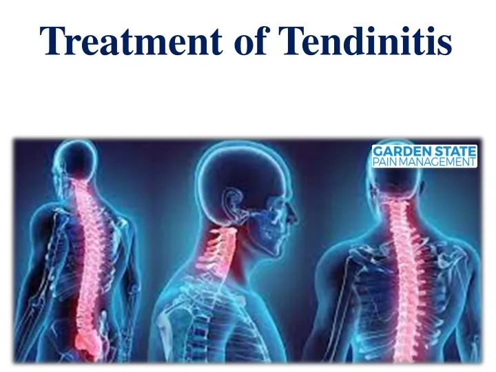 treatment of tendinitis