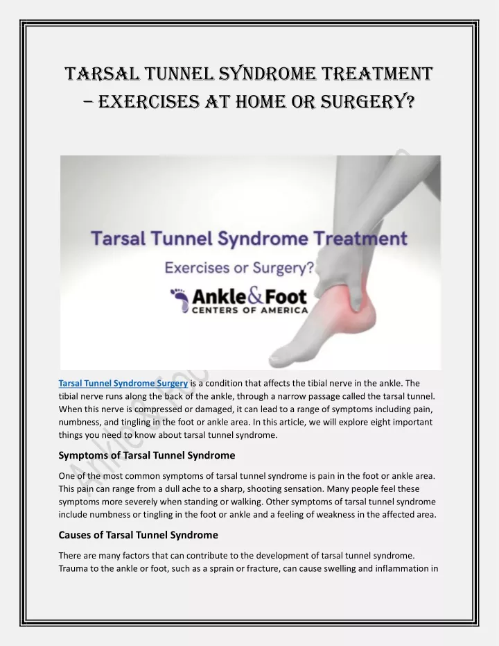 tarsal tunnel syndrome treatment exercises