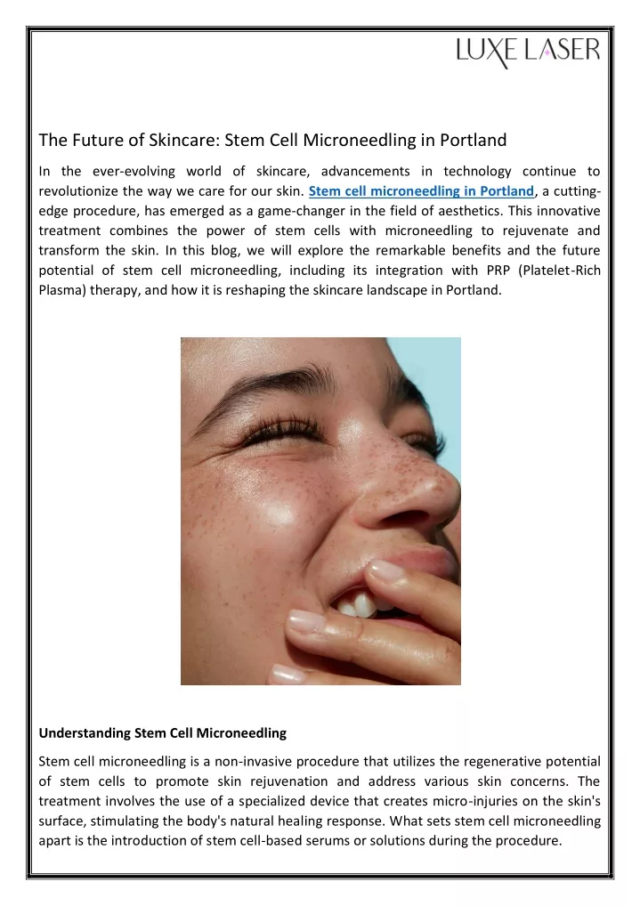 the future of skincare stem cell microneedling