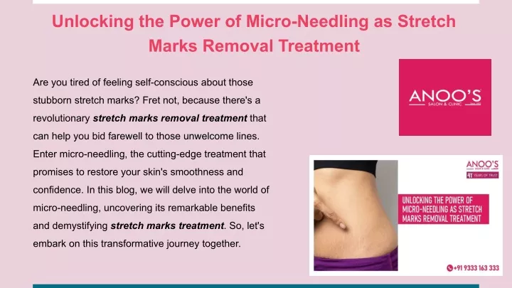 unlocking the power of micro needling as stretch