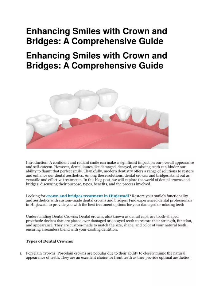 enhancing smiles with crown and bridges