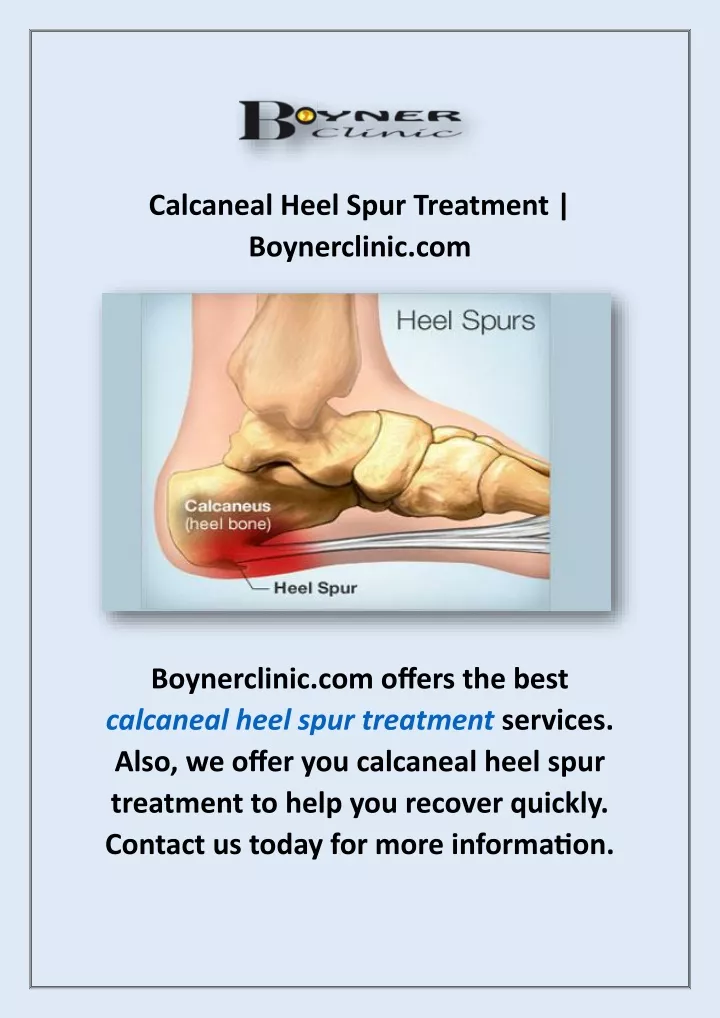 calcaneal heel spur treatment boynerclinic com