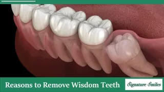 4 Reasons to Get Your Wisdom Teeth Removed Right Away!