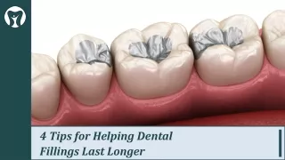 The Duration of Dental Fillings