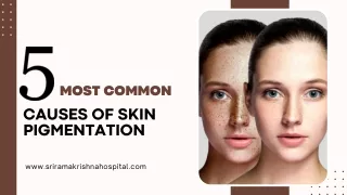 5 Most Common Causes of Skin Pigmentation