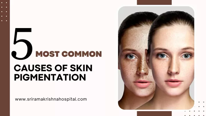 most common causes of skin pigmentation