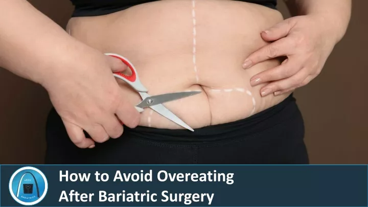 how to avoid overeating after bariatric surgery